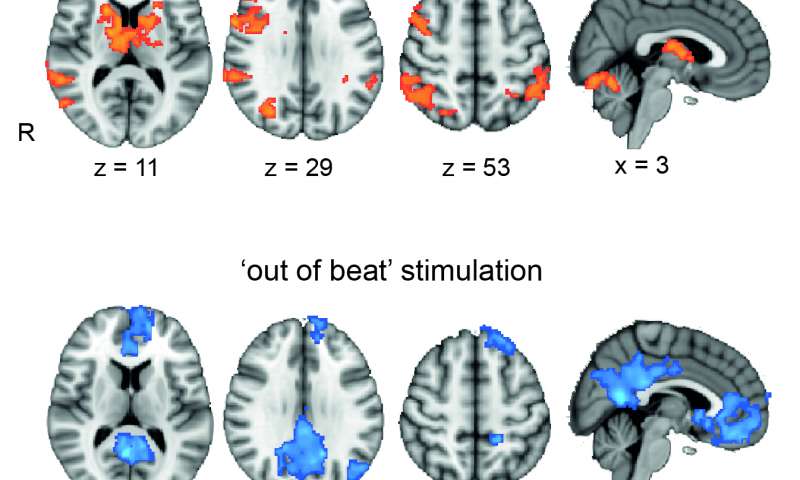 Buzzing the brain with electricity can boost working memory