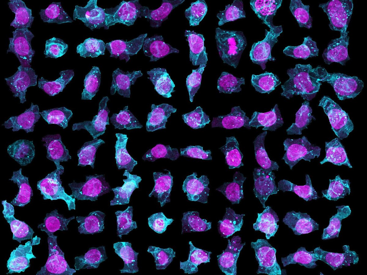 Massive 3-D Cell Library Teaches Computers How to Find Mitochondria