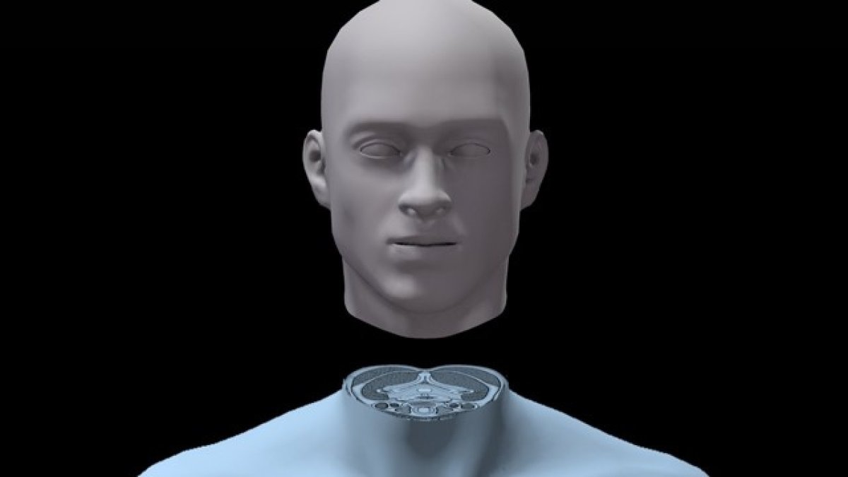 No, there has not been a successful human head transplant