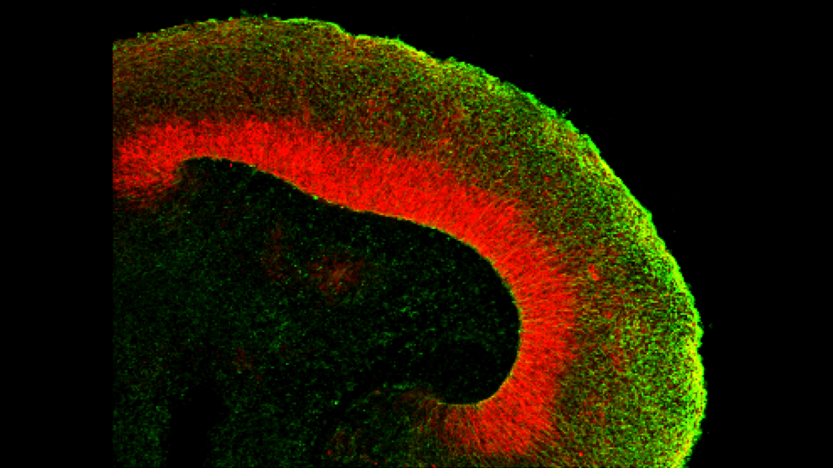 Human Brain Organoids Implanted Into Rodents