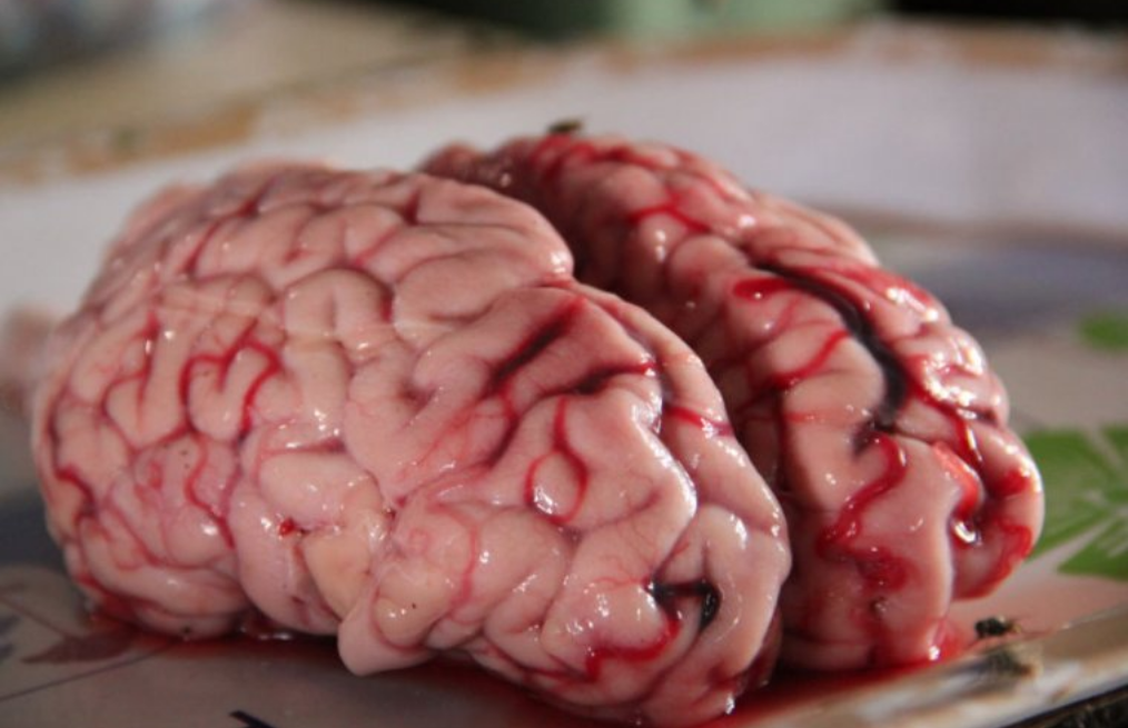 Human brain cells can make complex structures in a dish—is this a problem?