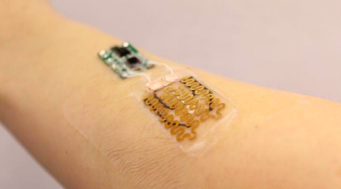 Futuristic bandage can monitor wounds and deliver drug treatment