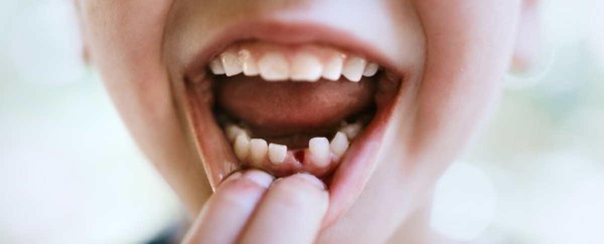 Stem Cells From Baby Teeth Could Be Used to Bring Back a Dead Tooth