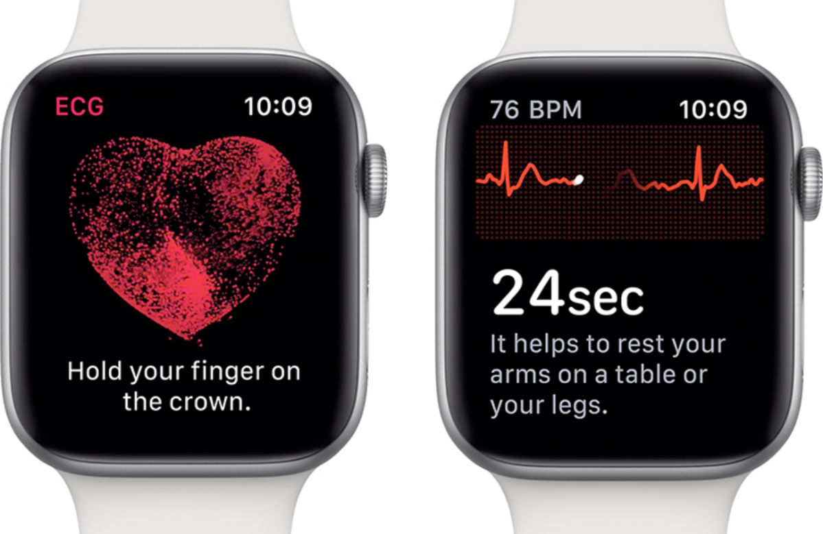 ECG Feature on Apple Watch Could Take Years to Be Approved in the United Kingdom